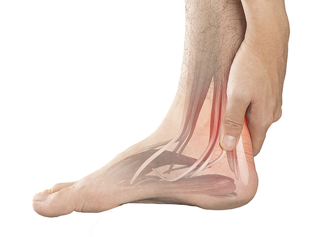 heel pain