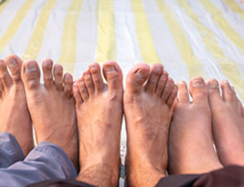 How Can You Treat and Prevent Toenail Fungus?