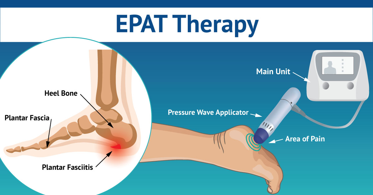 Shockwave Therapy Relieves Heel Spur Pain