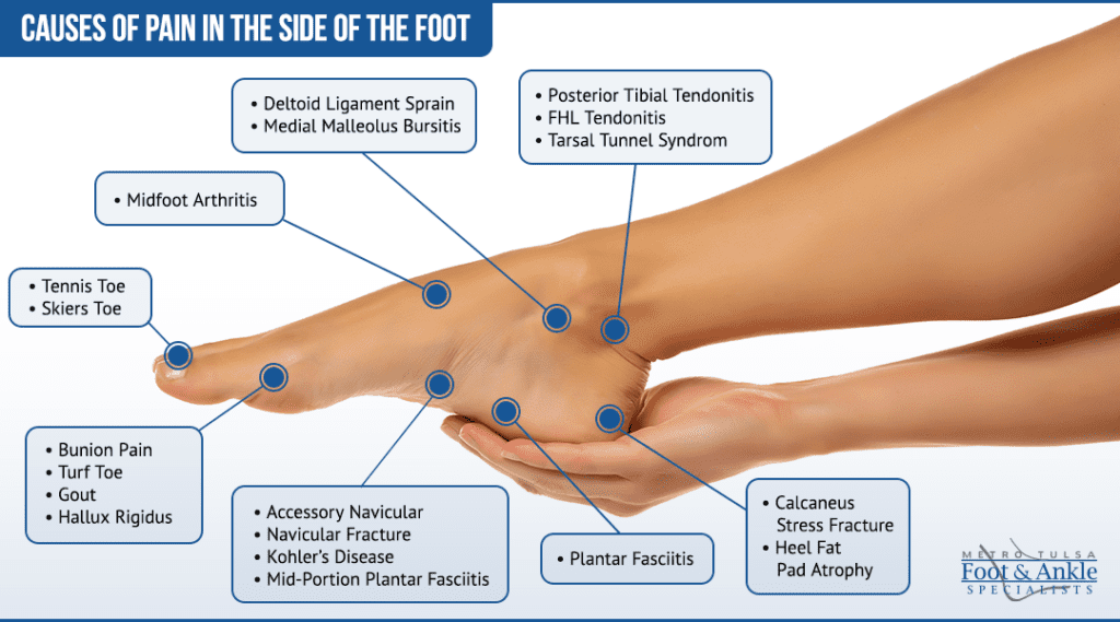 Foot Pain Chart | Metro Tulsa Foot & Ankle