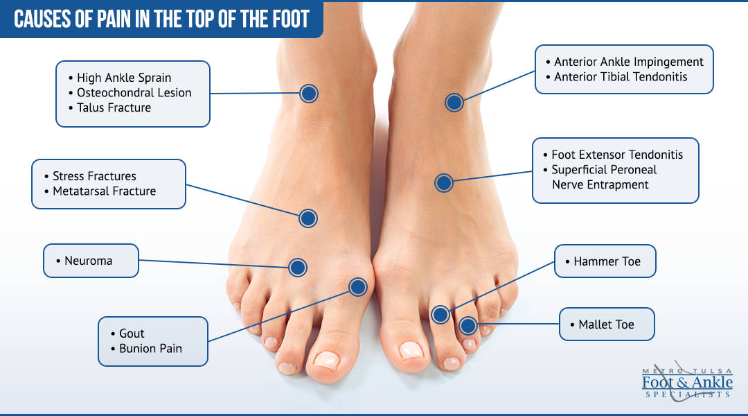 foot-pain-chart-metro-tulsa-foot-ankle