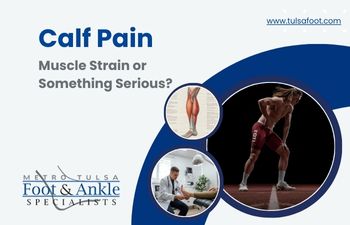 calf muscle strain treatment